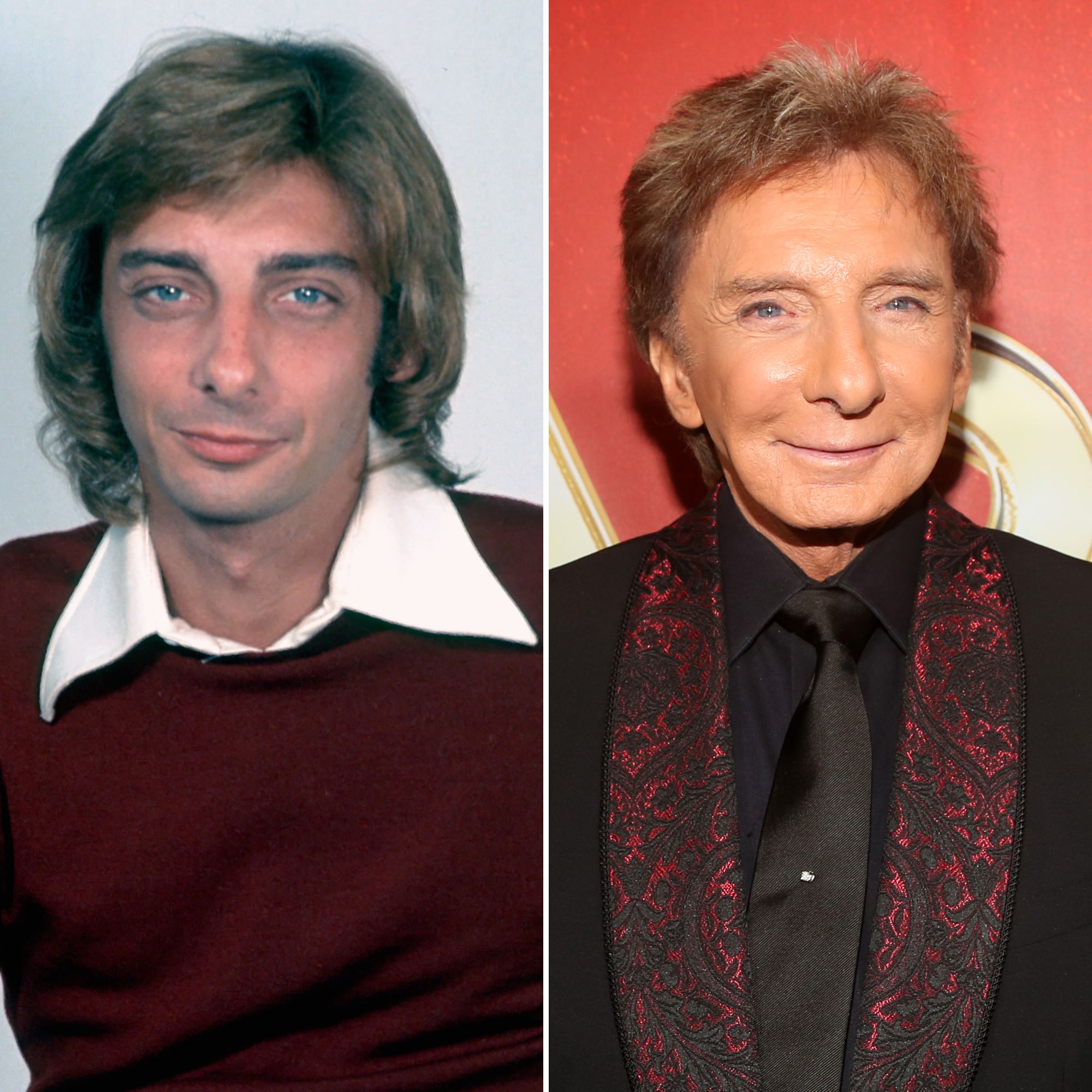 Whats the truth about plastic surgery barry manilow and the procedures people think he had for a new look?