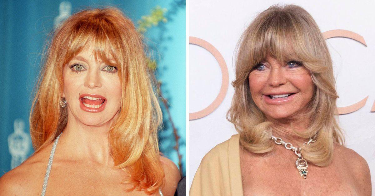 The big question: How many Goldie Hawn face lifts contribute to her timeless beauty today?