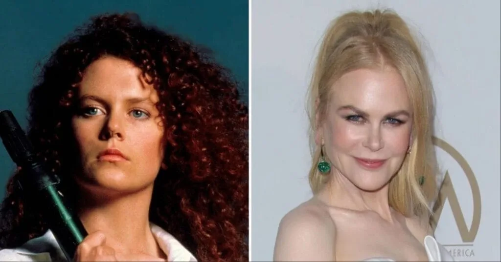 What work did Nicole Kidman have done? (Analyzing her before after plastic surgery photos for clues!)
