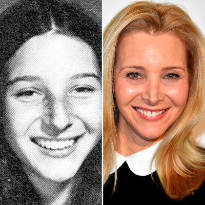 Lisa Kudrow Rhinoplasty: Real Transformation or Just Rumors?